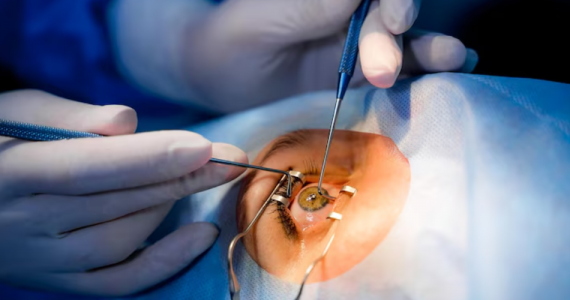 Is lasik eye surgery worth it